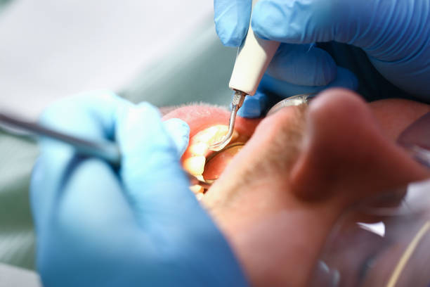 Best Knocked-Out Tooth Emergency  in Glenville, WV